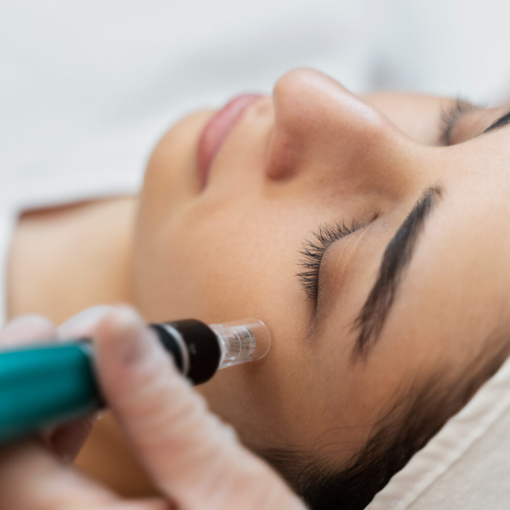 Cât Costă Mezoterapia cu Dermapen în București – Prețuri 2026