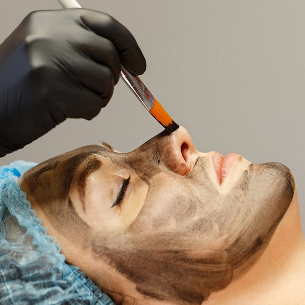 Hollywood Peel
